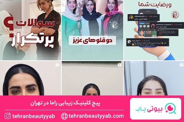 بهترین کلینیک کاشت ابرو در تهران