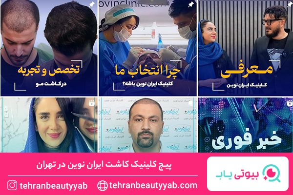 بهترین کلینیک کاشت مو در تهران