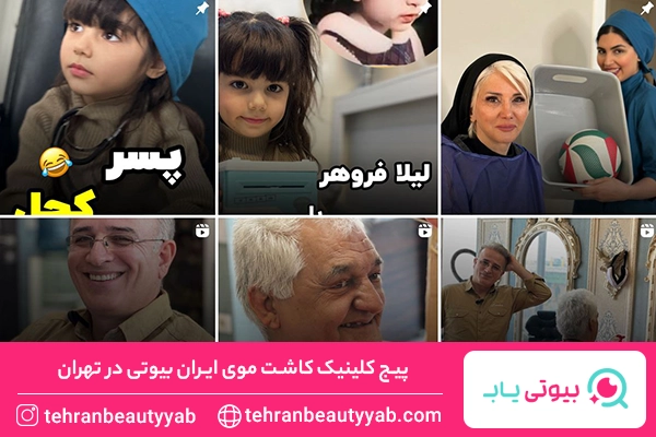 بهترین کلینیک کاشت مو در تهران