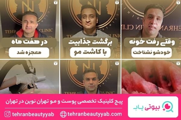 بهترین کلینیک کاشت مو در تهران
