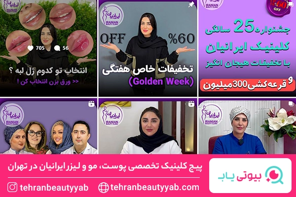 بهترین کلینیک کاشت مو در تهران