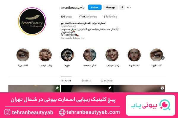 کاشت ابرو در شمال تهران