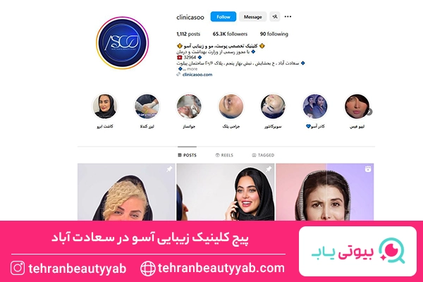 کاشت ابرو سعادت آباد