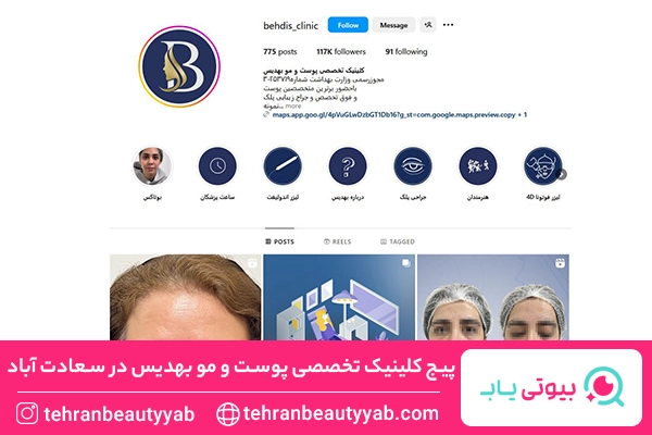 کاشت ابرو سعادت آباد