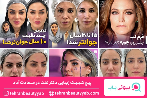 کلینیک زیبایی در سعادت آباد