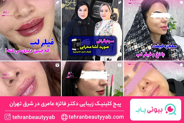 کلینیک زیبایی در شرق تهران