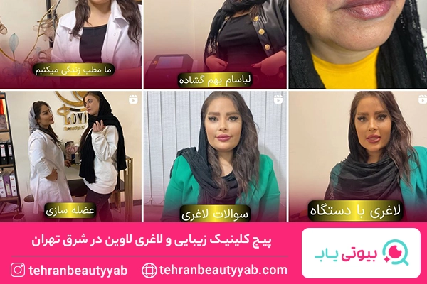 کلینیک زیبایی در شرق تهران