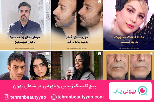کلینیک زیبایی شمال تهران
