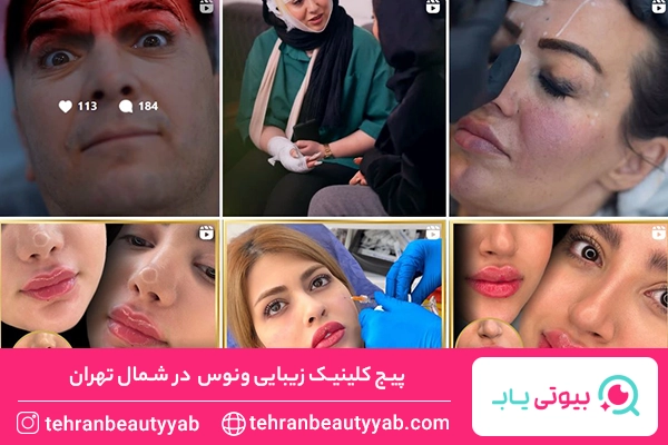 کلینیک زیبایی شمال تهران