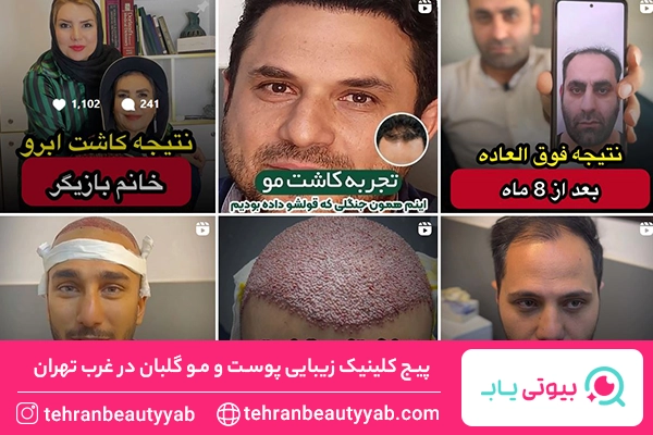 کلینیک زیبایی غرب تهران