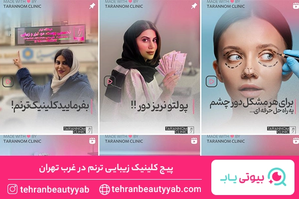 کلینیک کاشت ابرو در غرب تهران