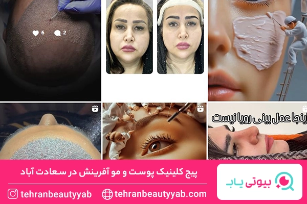 کلینیک کاشت مو سعادت اباد