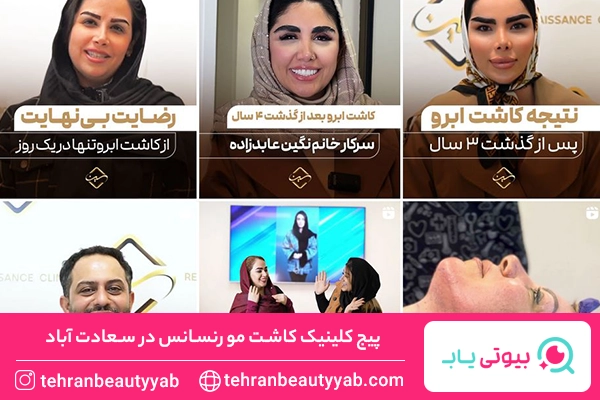 کلینیک کاشت مو سعادت اباد