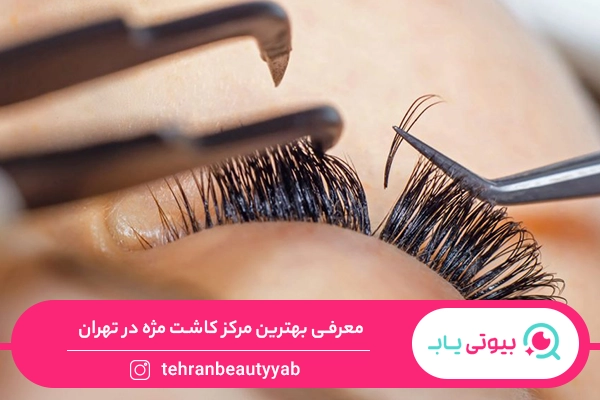 بهترین مرکز کاشت مژه در تهران