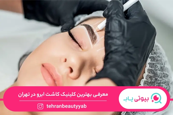 بهترین کلینیک کاشت ابرو در تهران
