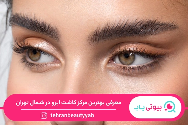 کاشت ابرو در شمال تهران