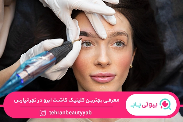 کلینیک کاشت ابرو در تهرانپارس