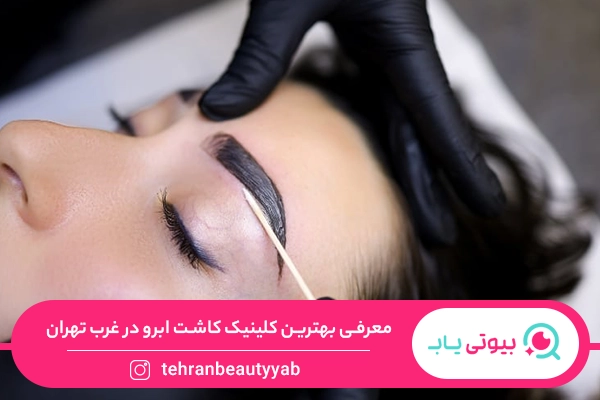 کلینیک کاشت ابرو در غرب تهران