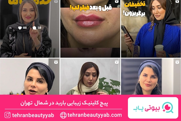 بهترین مرکز لیزر شمال تهران