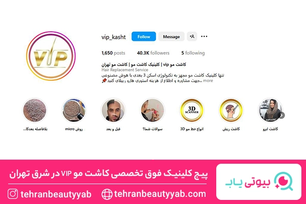 کاشت مو شرق تهران