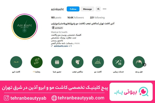 کاشت مو شرق تهران