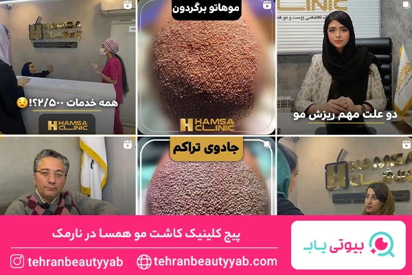کلینیک کاشت مو نارمک