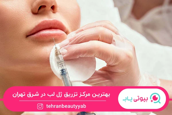 بهترین مرکز تزریق ژل لب در شرق تهران