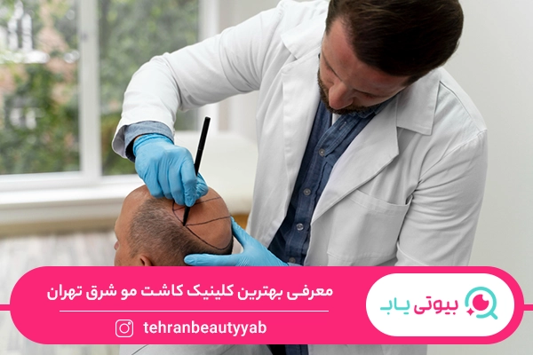 کاشت مو شرق تهران