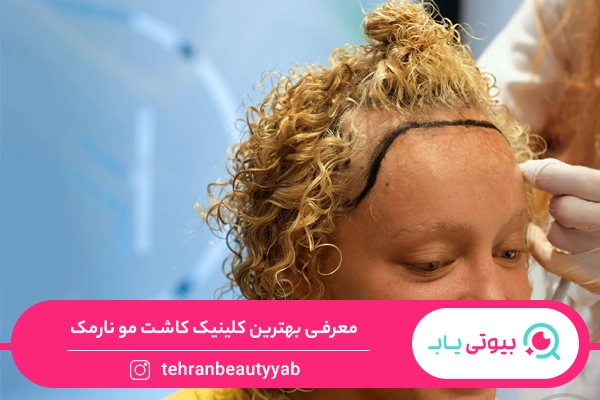 کلینیک کاشت مو نارمک