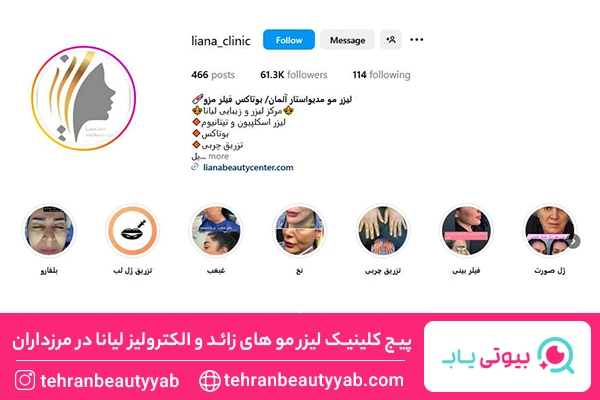 لیزر موهای زائد در مرزداران