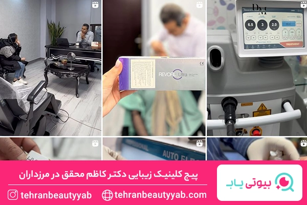 لیزر موهای زائد در مرزداران