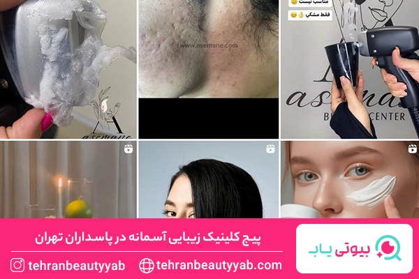 مرکز لیزر پاسداران تهران