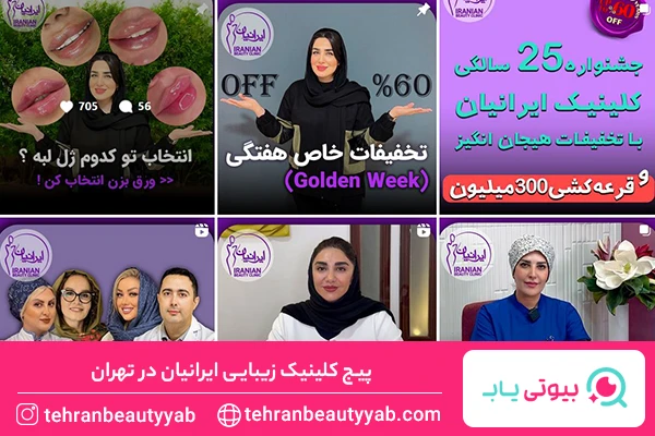 بهترین مرکز بوتاکس در تهران