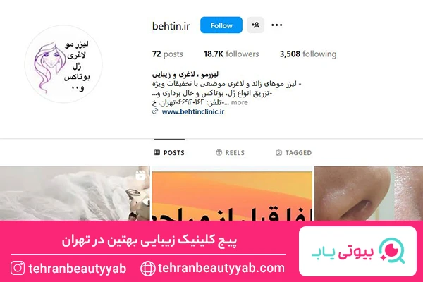 بهترین مرکز بوتاکس در تهران