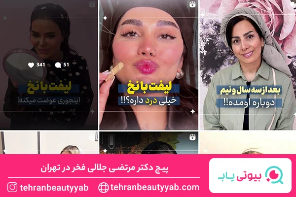 بهترین کلینیک لیفت با نخ تهران