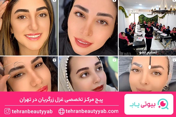 فیبروز ابرو در تهران