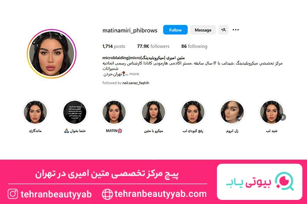 فیبروز ابرو در تهران