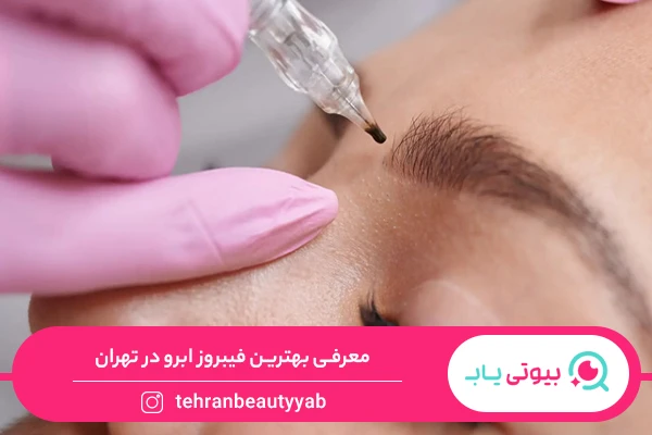 فیبروز ابرو در تهران
