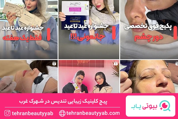 بهترین مرکز لیفت با نخ در شهرک غرب