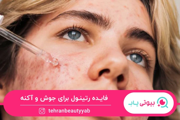 خواص رتینول برای پوست