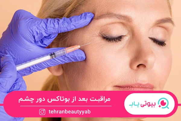 نکات مراقبت بعد از بوتاکس