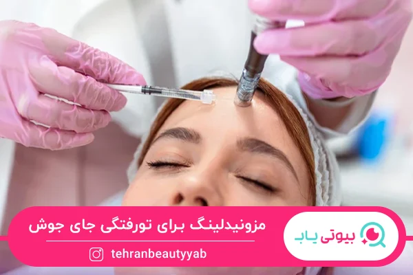 بهترین روش برای از بین بردن سوراخ های جای جوش