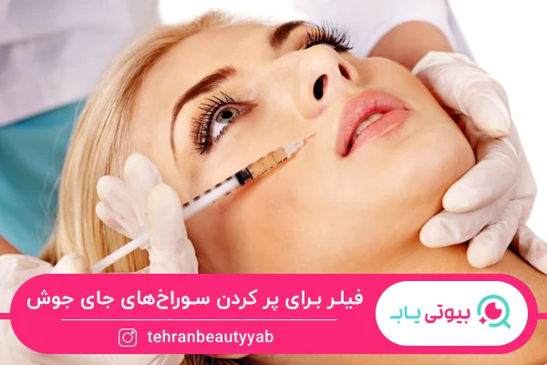 بهترین روش برای از بین بردن سوراخ های جای جوش