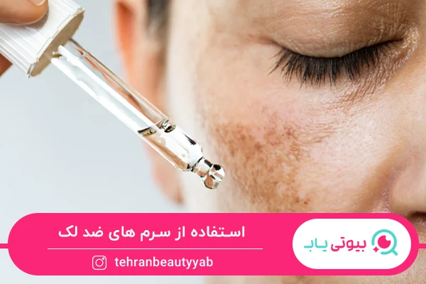 درمان خانگی لکه های قهوه ای روی صورت