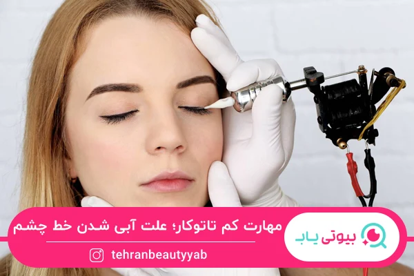 علت آبی شدن تاتو خط چشم