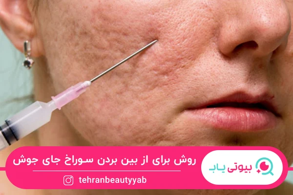 بهترین روش برای از بین بردن سوراخ های جای جوش