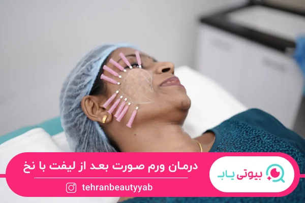 درمان ورم صورت بعد از لیفت با نخ
