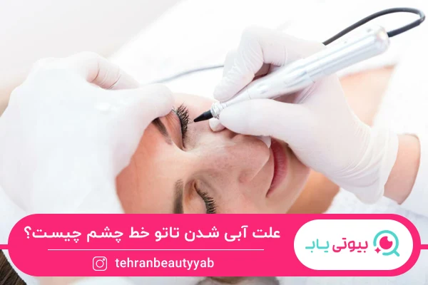 علت آبی شدن تاتو خط چشم