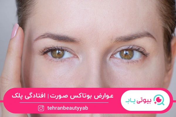 عوارض بوتاکس صورت