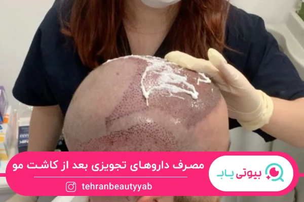 مراقبت بعد از کاشت مو